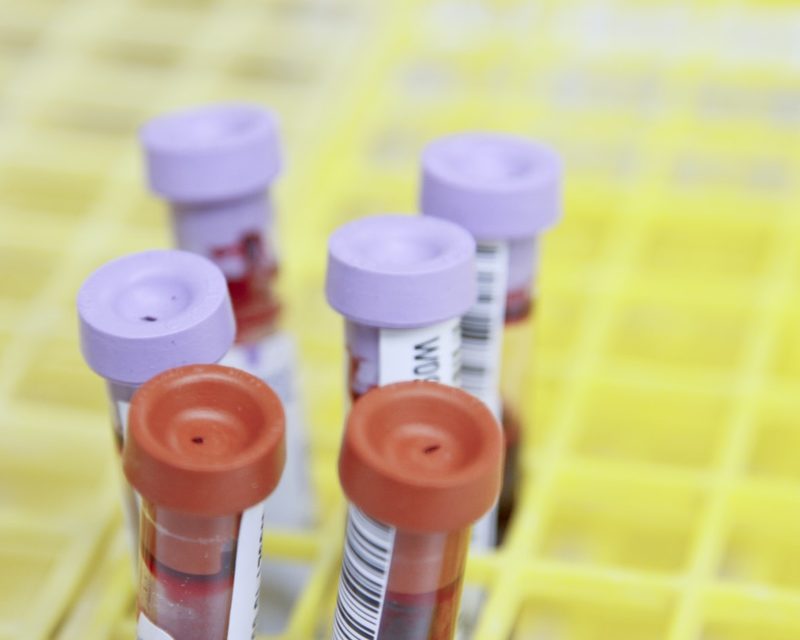 Related Blood 1