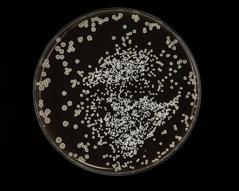 Microbial colonies in a culture dish
